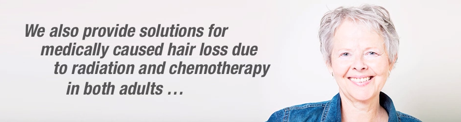 Cancer-Related-Hair-Replacement-los-angeles-CA
