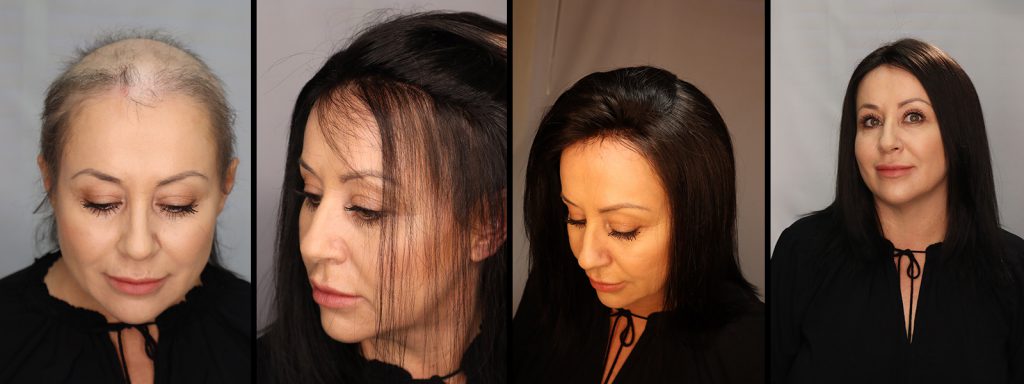 womens-hair-replacement-salon-woodland-hills-ca